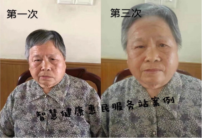 中风后遗症2