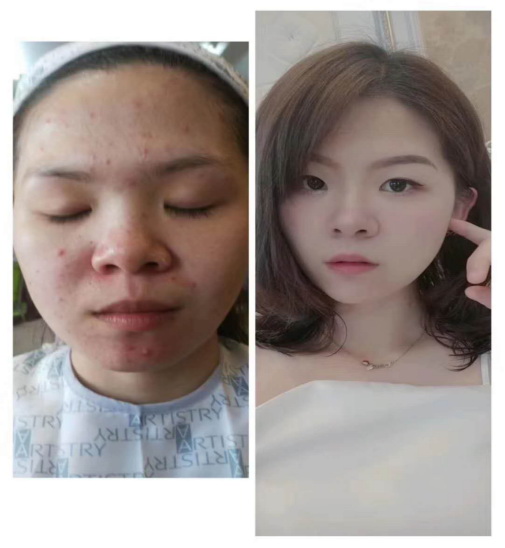 中医美容2