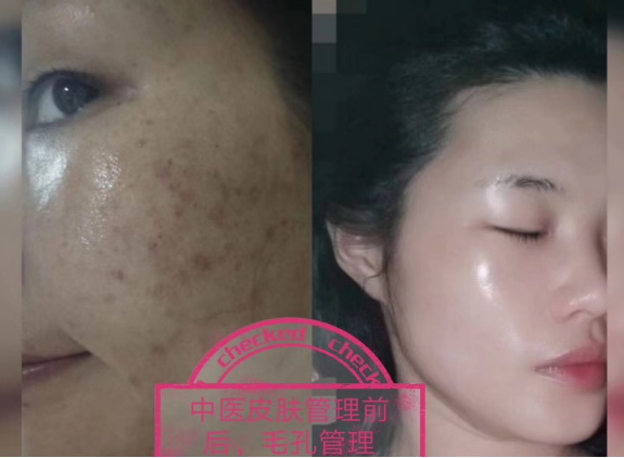 中医美容1